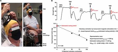 The Exercising Brain: An Overlooked Factor Limiting the Tolerance to Physical Exertion in Major Cardiorespiratory Diseases?